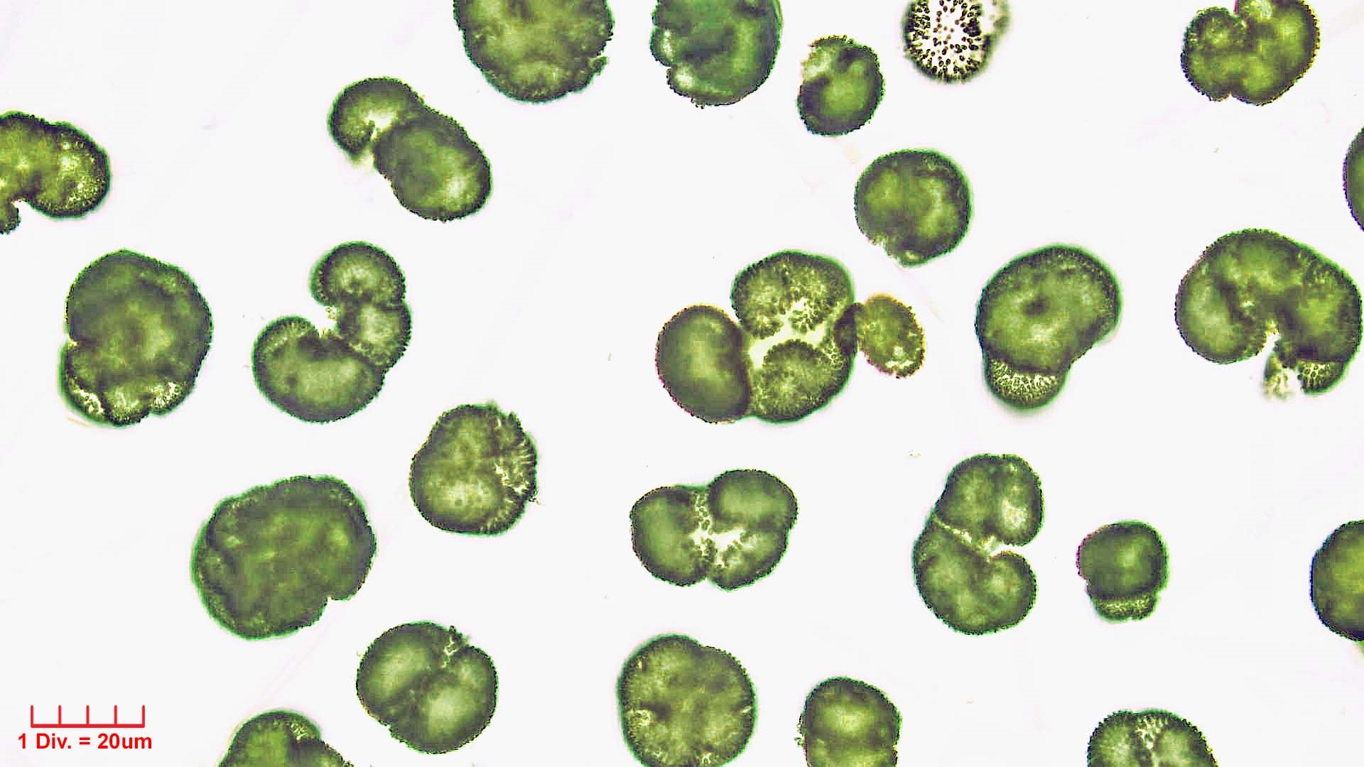 Cyanobacteria/Synechococcales/Coleosphaeriaceae/Woronichinia/naegeliana/woronichinia-naegeliana-105.jpg