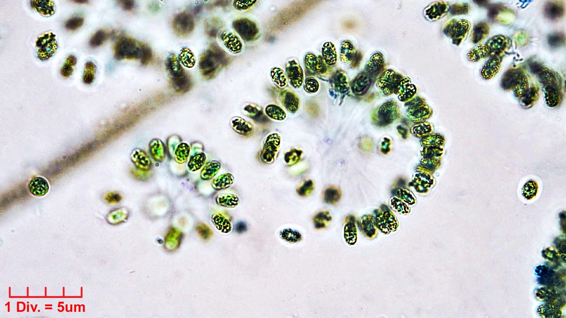 Cyanobacteria/Synechococcales/Coleosphaeriaceae/Woronichinia/naegeliana/woronichinia-naegeliana-107.jpg