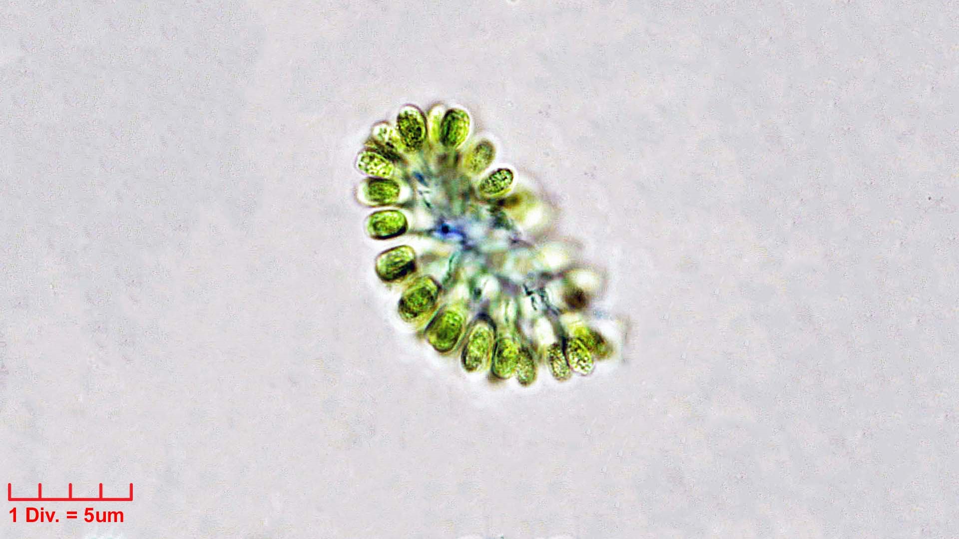 Cyanobacteria/Synechococcales/Coleosphaeriaceae/Woronichinia/naegeliana/woronichinia-naegeliana-108.jpg