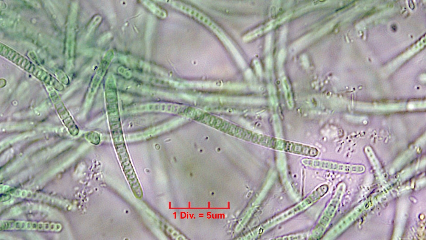 Cyanobacteria/Synechococcales/Leptolyngbyaceae/Leptolyngbya/foveolarum_cf/leptolyngbya-foveolarum-121.jpg