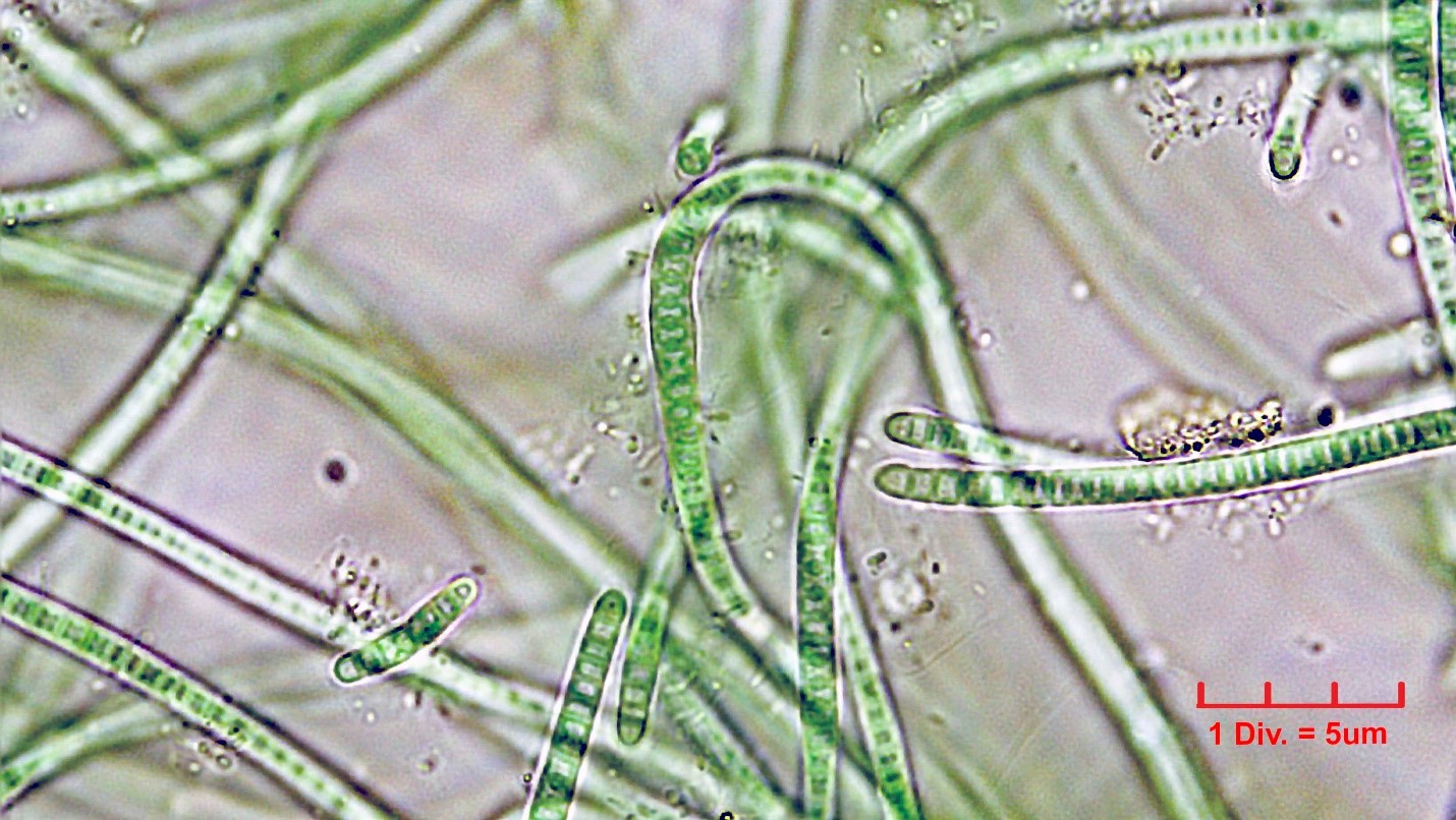 Cyanobacteria/Synechococcales/Leptolyngbyaceae/Leptolyngbya/foveolarum_cf/leptolyngbya-foveolarum-122.jpg