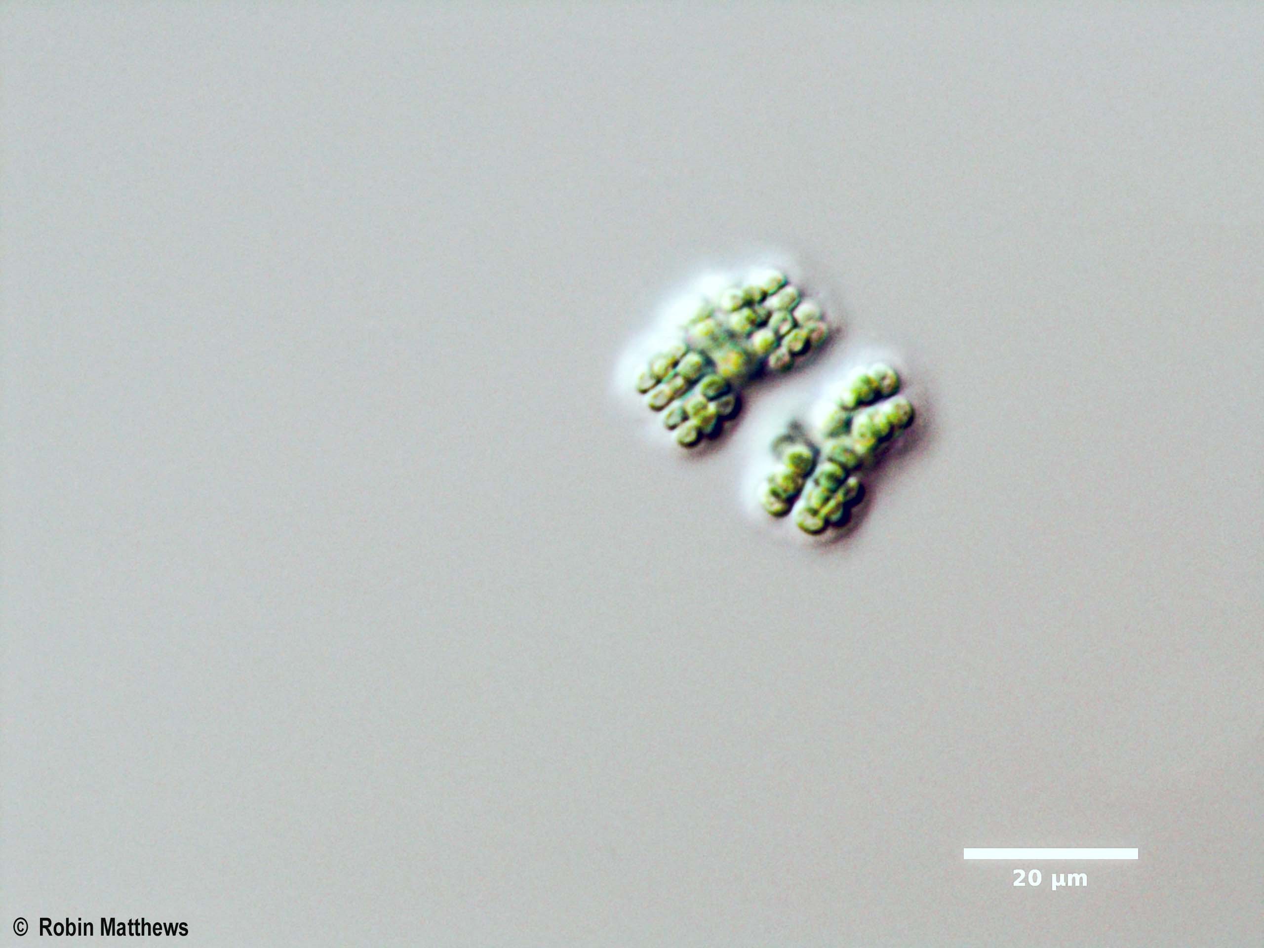 Cyanobacteria/Synechococcales/Merismopediaceae/Eucapsis/minor/eucapsis-minor-116.jpg
