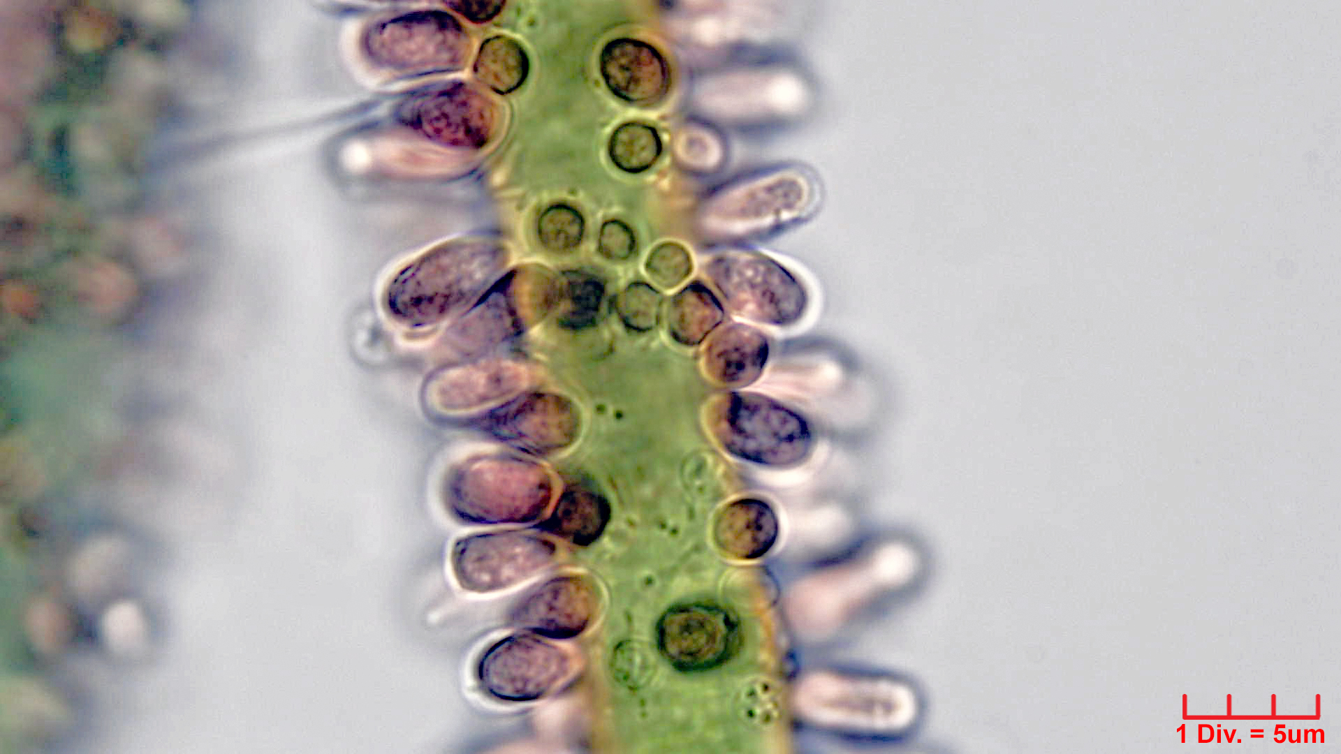 ./Cyanobacteria/Synechococcales/Merismopediaceae/Microcrocis/geminata/microcrocis-geminata-2.jpg