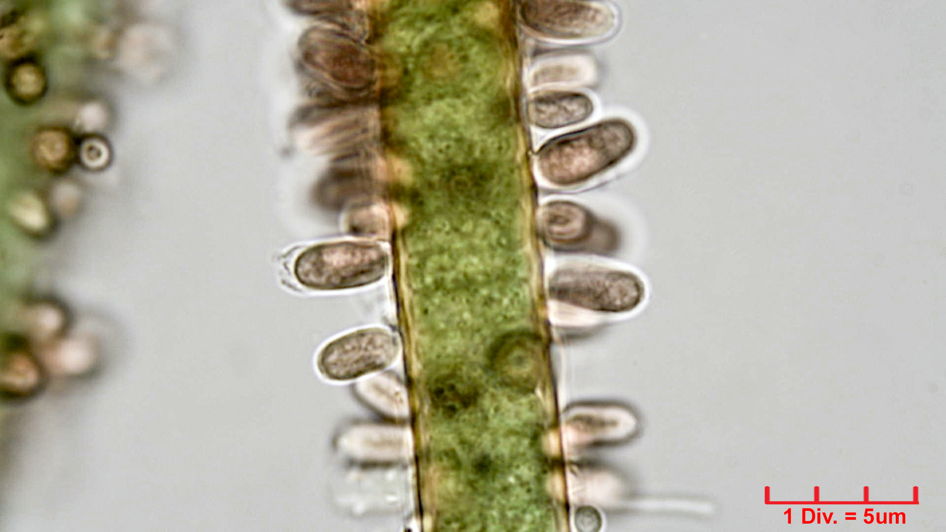 ./Cyanobacteria/Synechococcales/Merismopediaceae/Microcrocis/geminata/microcrocis-geminata-3.jpg
