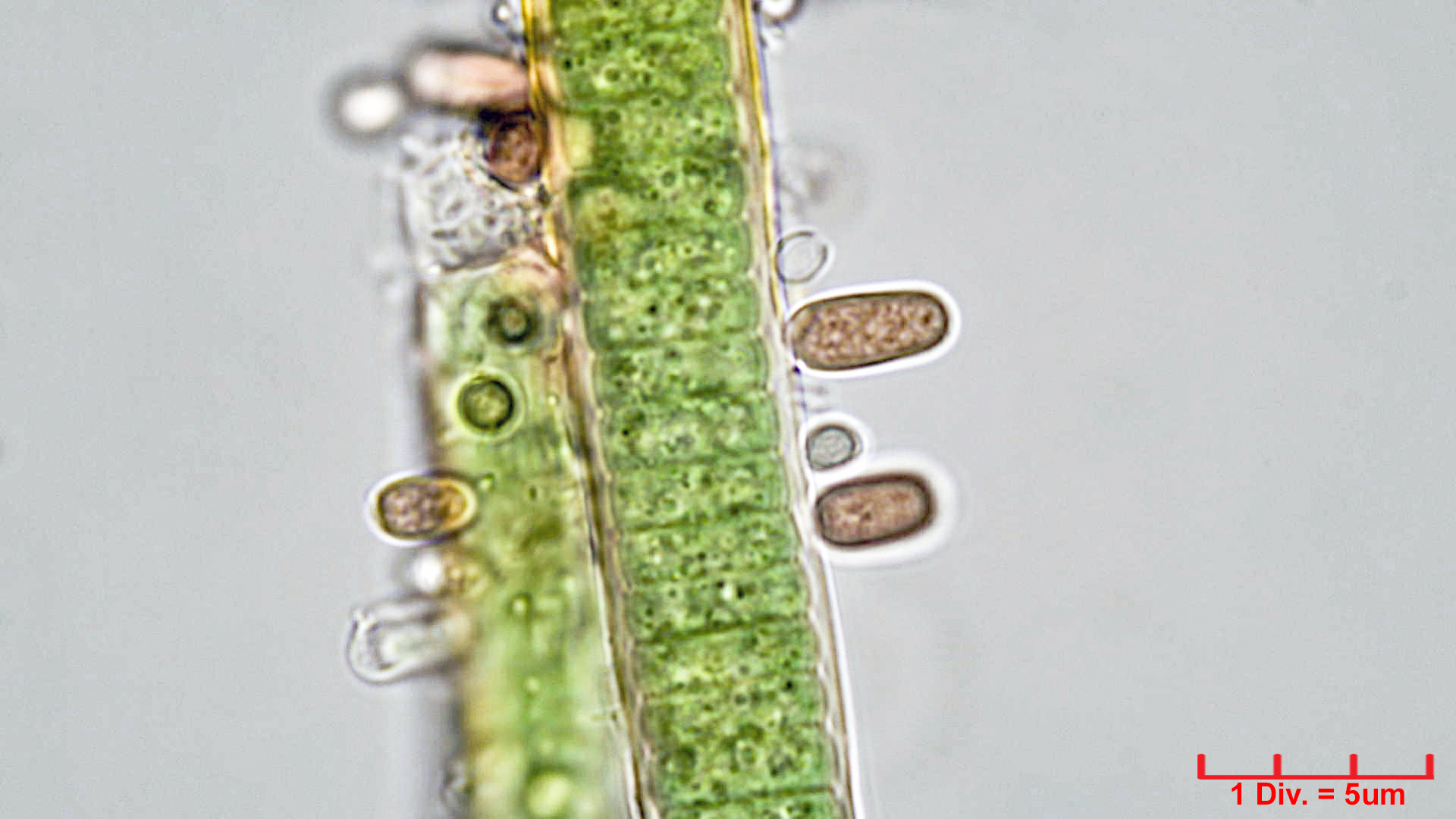 ./Cyanobacteria/Synechococcales/Merismopediaceae/Microcrocis/geminata/microcrocis-geminata-4.jpg