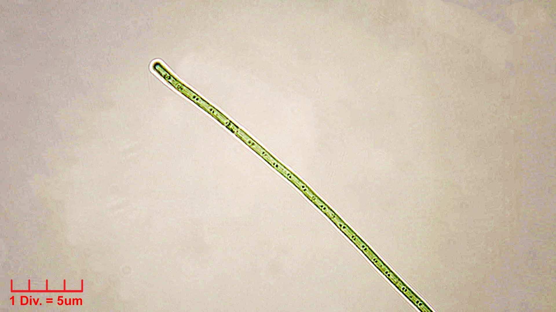 Cyanobacteria/Synechococcales/Pseudanabaenaceae/Limnothrix/redekei/limnothrix-redekei-139.jpg