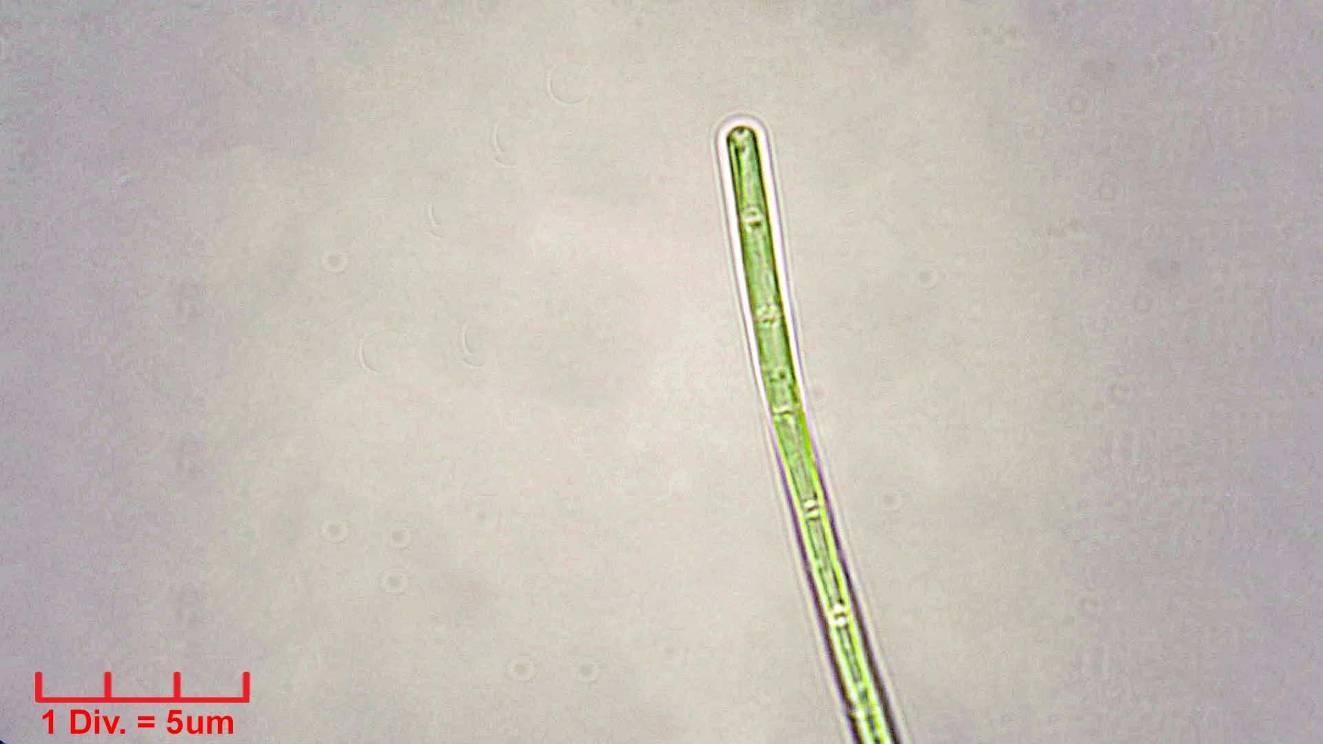 Cyanobacteria/Synechococcales/Pseudanabaenaceae/Limnothrix/redekei/limnothrix-redekei-140.jpg