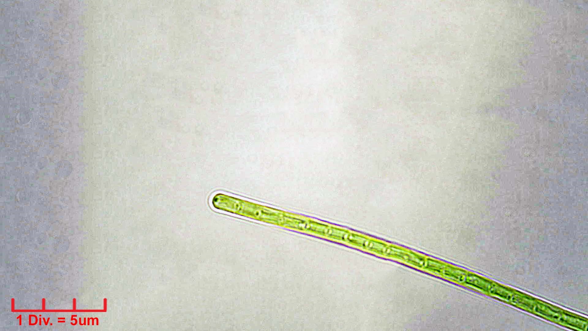 ./Cyanobacteria/Synechococcales/Pseudanabaenaceae/Limnothrix/redekei/limnothrix-redekei-142.jpg
