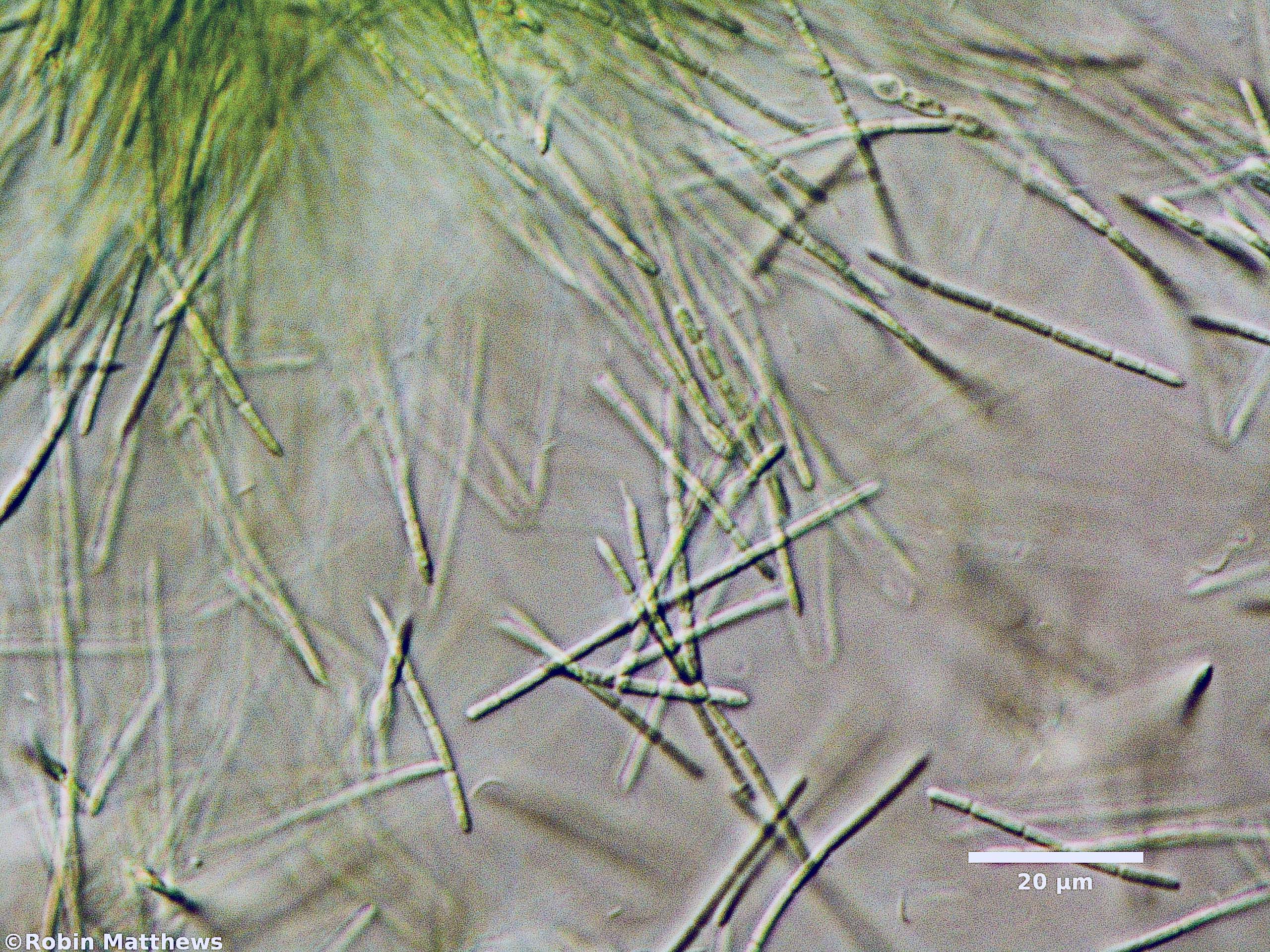 Cyanobacteria/Synechococcales/Pseudanabaenaceae/Pseudanabaena/sp/pseudanabaena-131.jpg