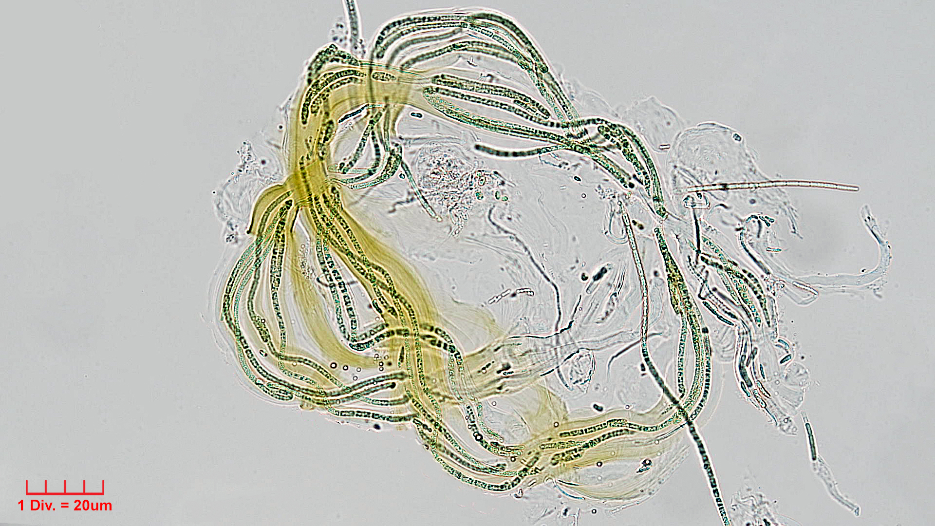 ./Cyanobacteria/Synechococcales/Schizotrichaceae/Dasygloea/lamyi/dasygloea-lamyi-1.jpg