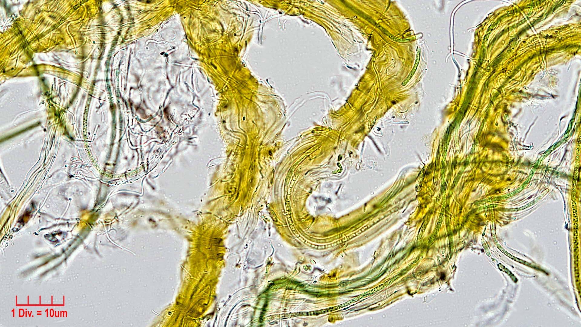Cyanobacteria/Synechococcales/Schizotrichaceae/Dasygloea/lamyi/dasygloea-lamyi-144.jpg