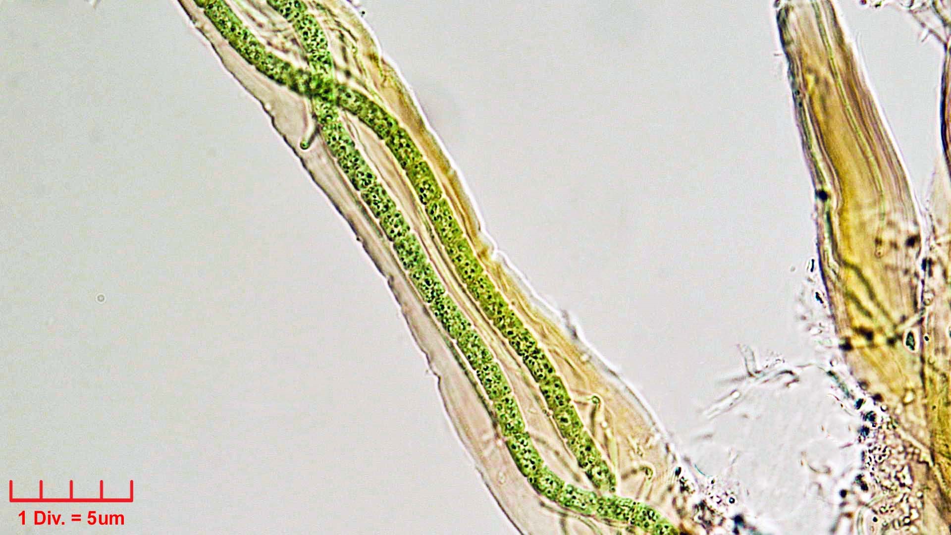 ./Cyanobacteria/Synechococcales/Schizotrichaceae/Dasygloea/lamyi/dasygloea-lamyi-146.jpg