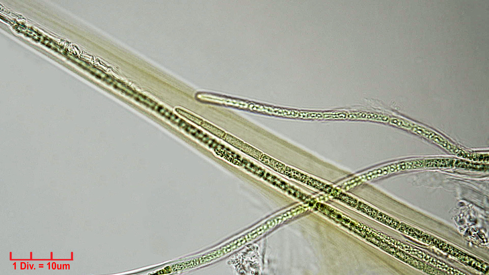Cyanobacteria/Synechococcales/Schizotrichaceae/Dasygloea/lamyi/dasygloea-lamyi-2.jpg