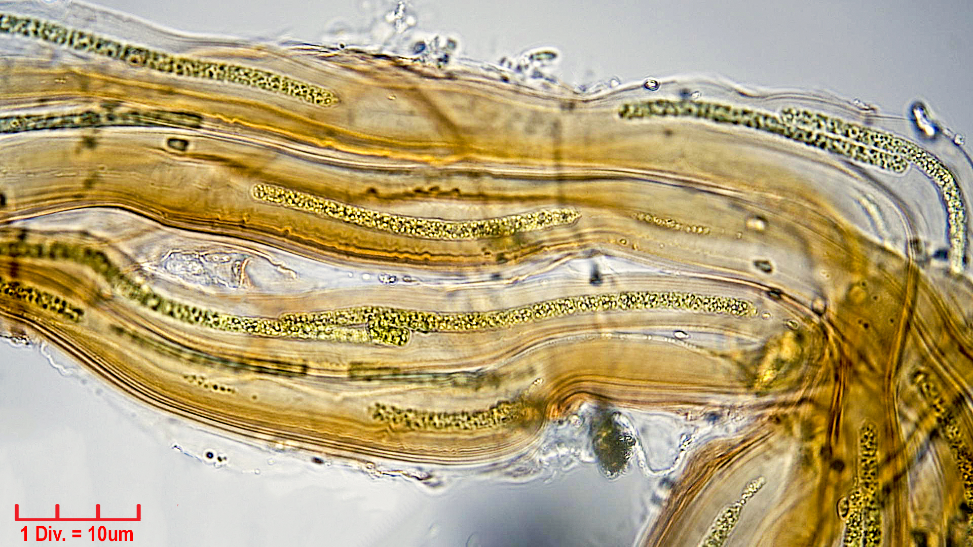 Cyanobacteria/Synechococcales/Schizotrichaceae/Dasygloea/lamyi/dasygloea-lamyi-5.jpg