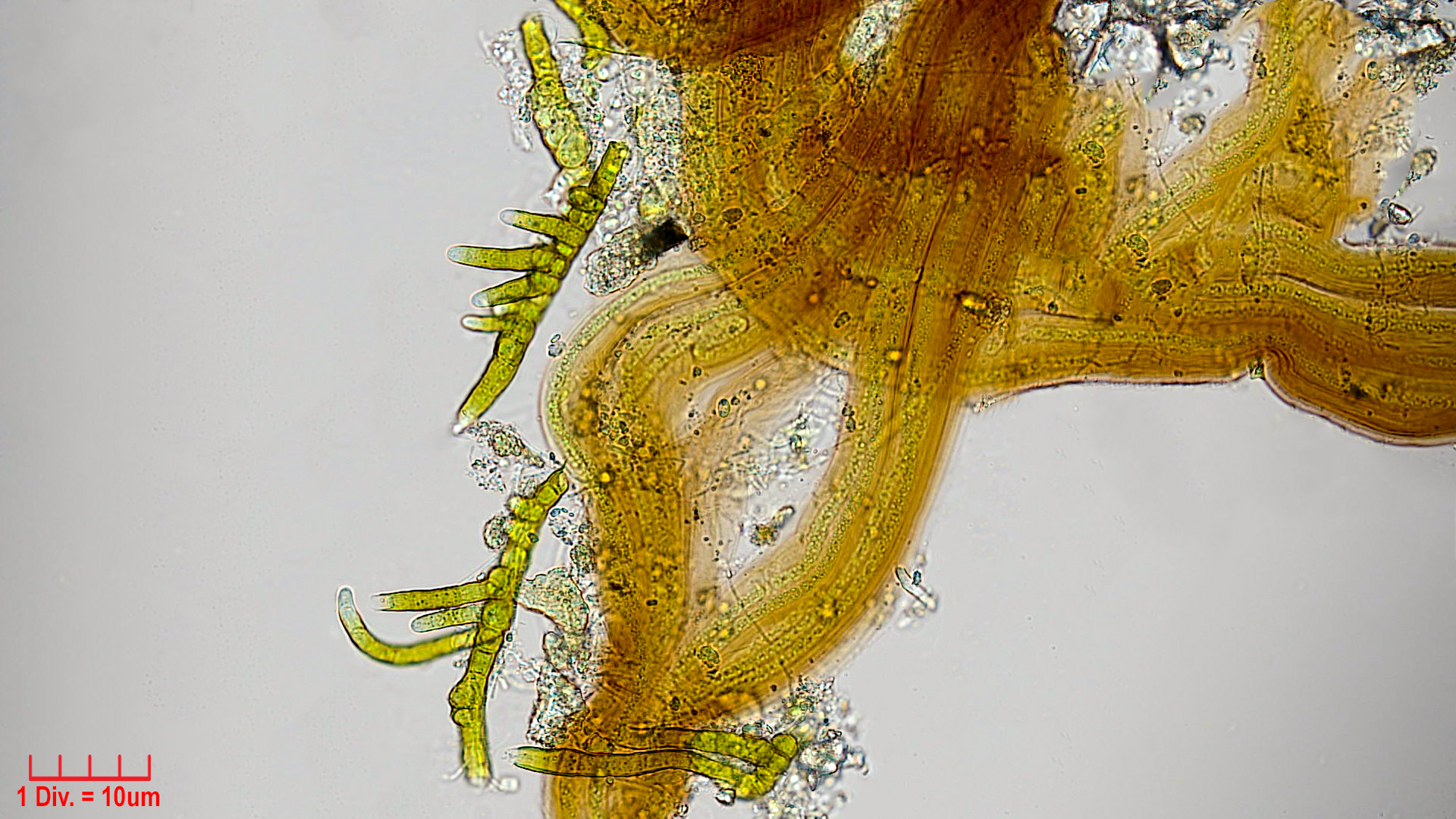 Cyanobacteria/Synechococcales/Schizotrichaceae/Dasygloea/lamyi/dasygloea-lamyi-7.jpg