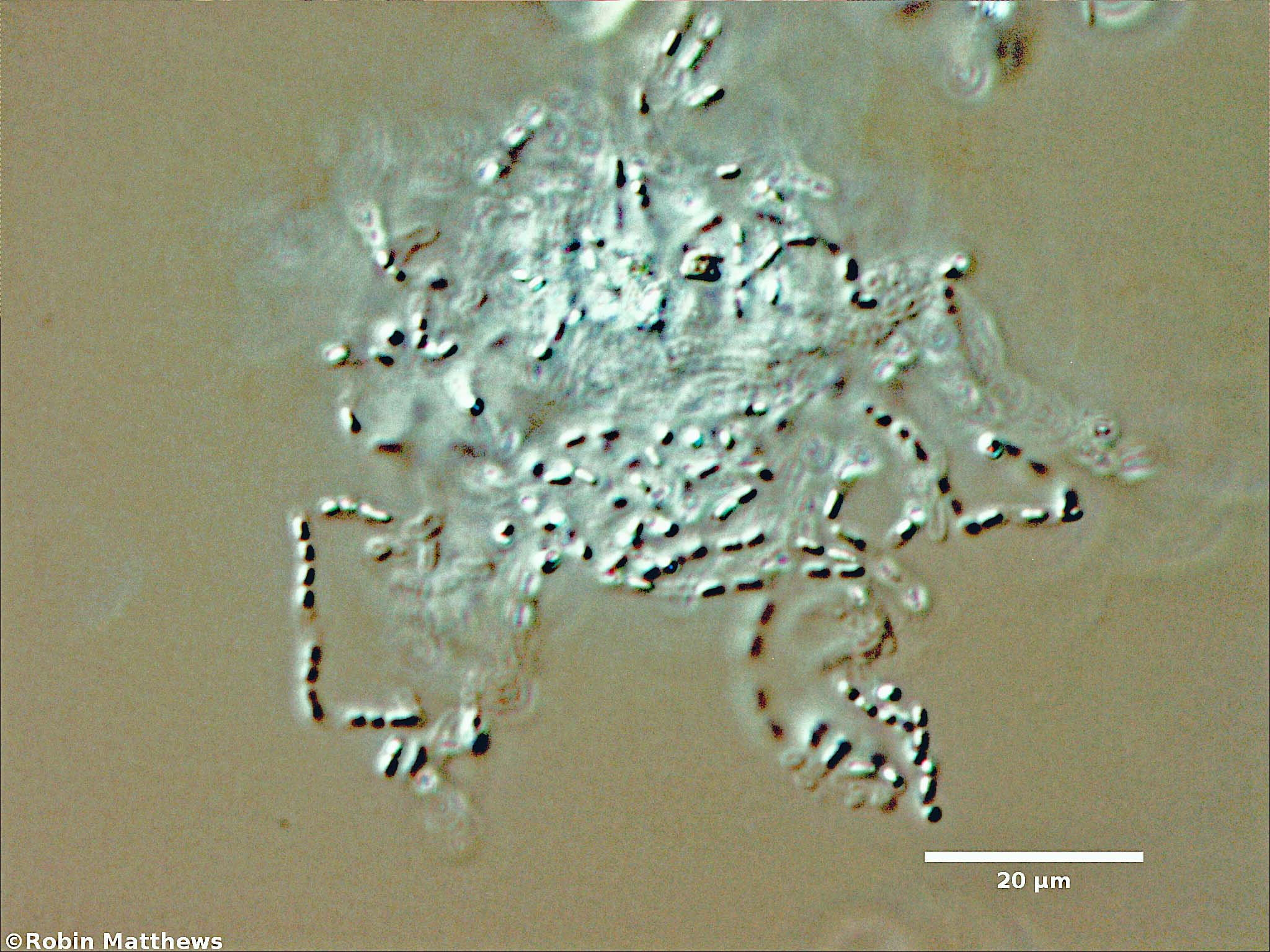 Cyanobacteria/Synechococcales/Synechococcaceae/Cyanodictyon/sp/cyanodictyon-75.jpg