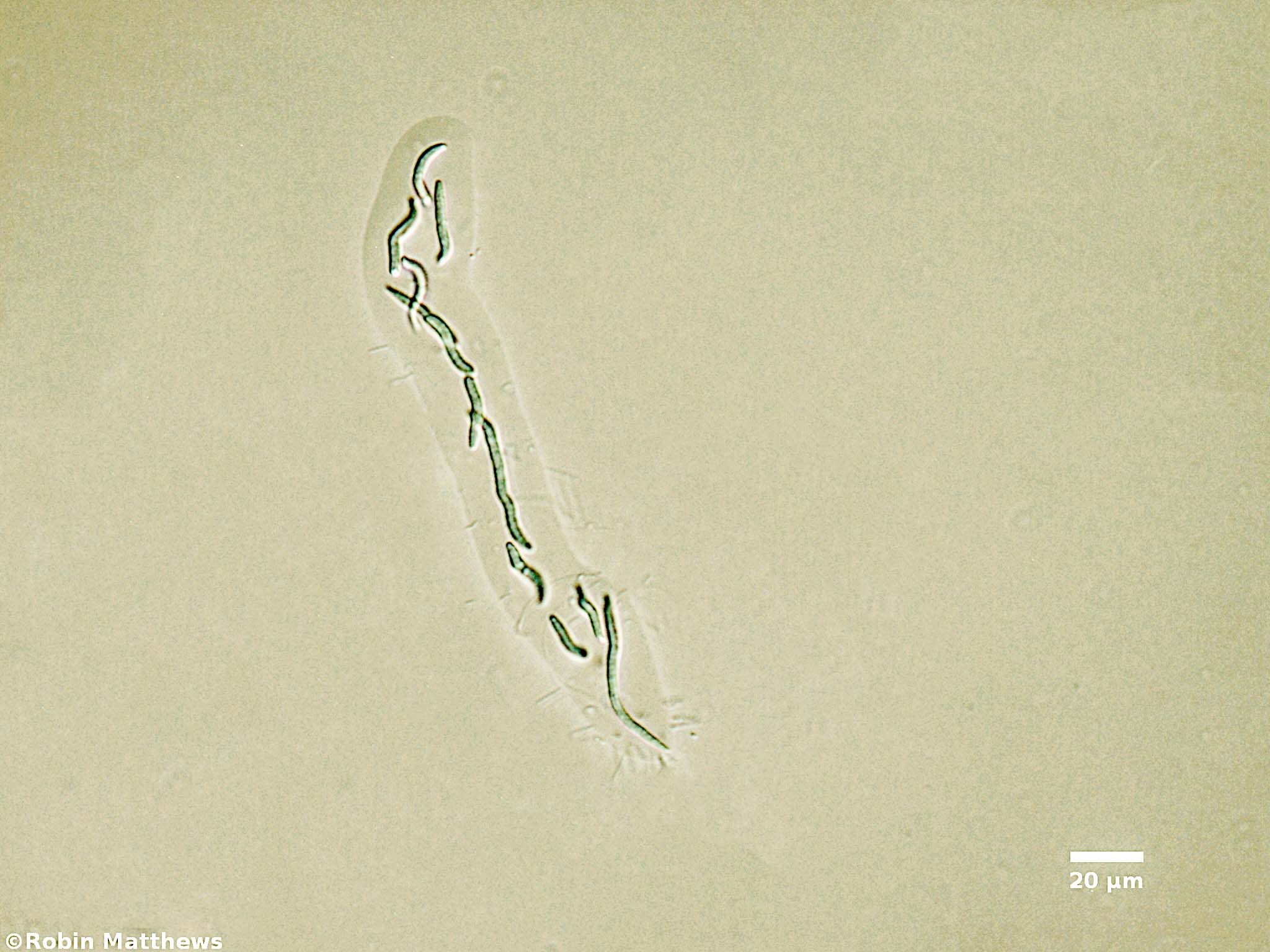 ./Cyanobacteria/Synechococcales/Synechococcaceae/Rhabdoderma/lineare/rhabdoderma-lineare-69.jpg