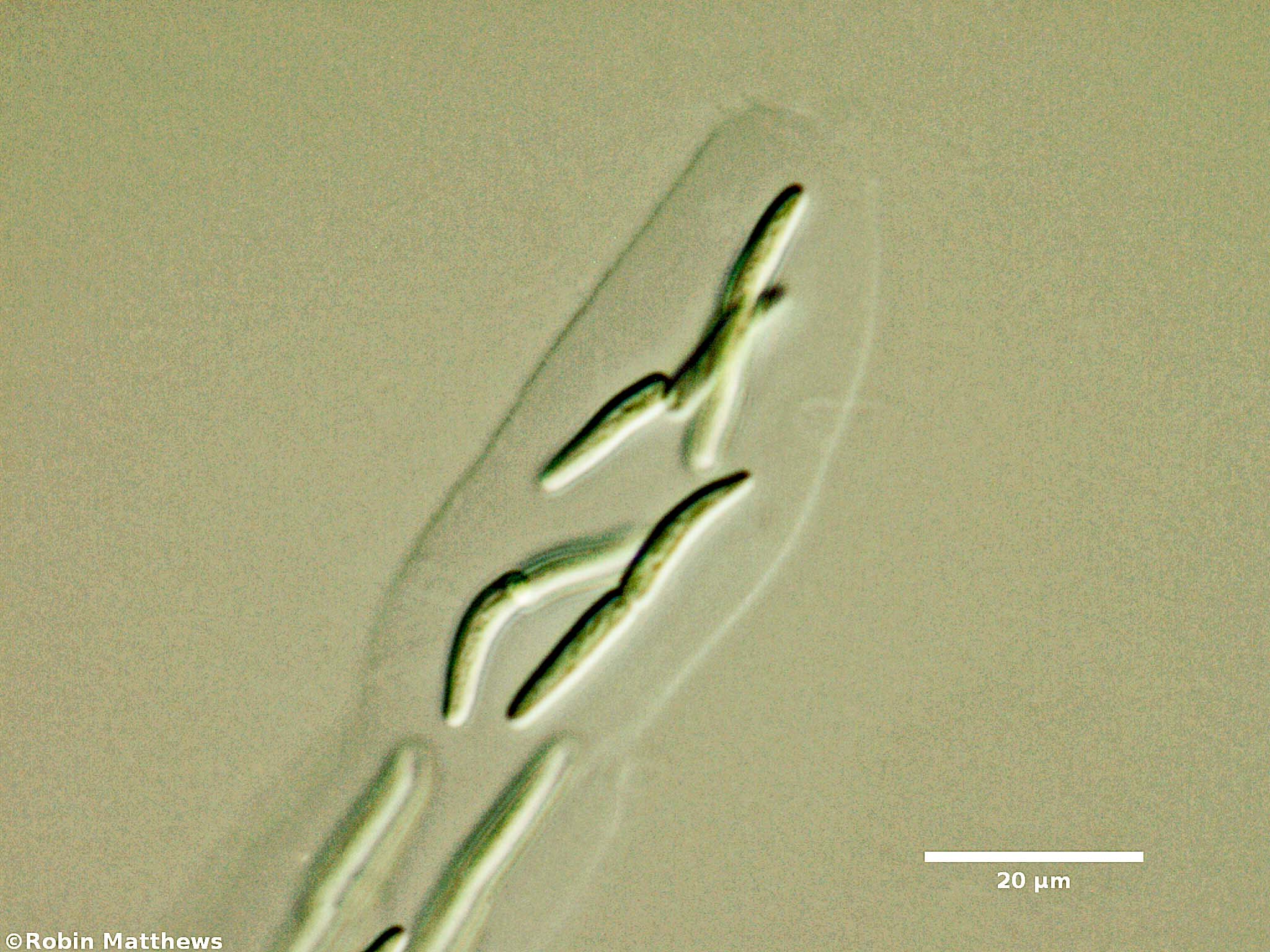 Cyanobacteria/Synechococcales/Synechococcaceae/Rhabdoderma/lineare/rhabdoderma-lineare-70.jpg