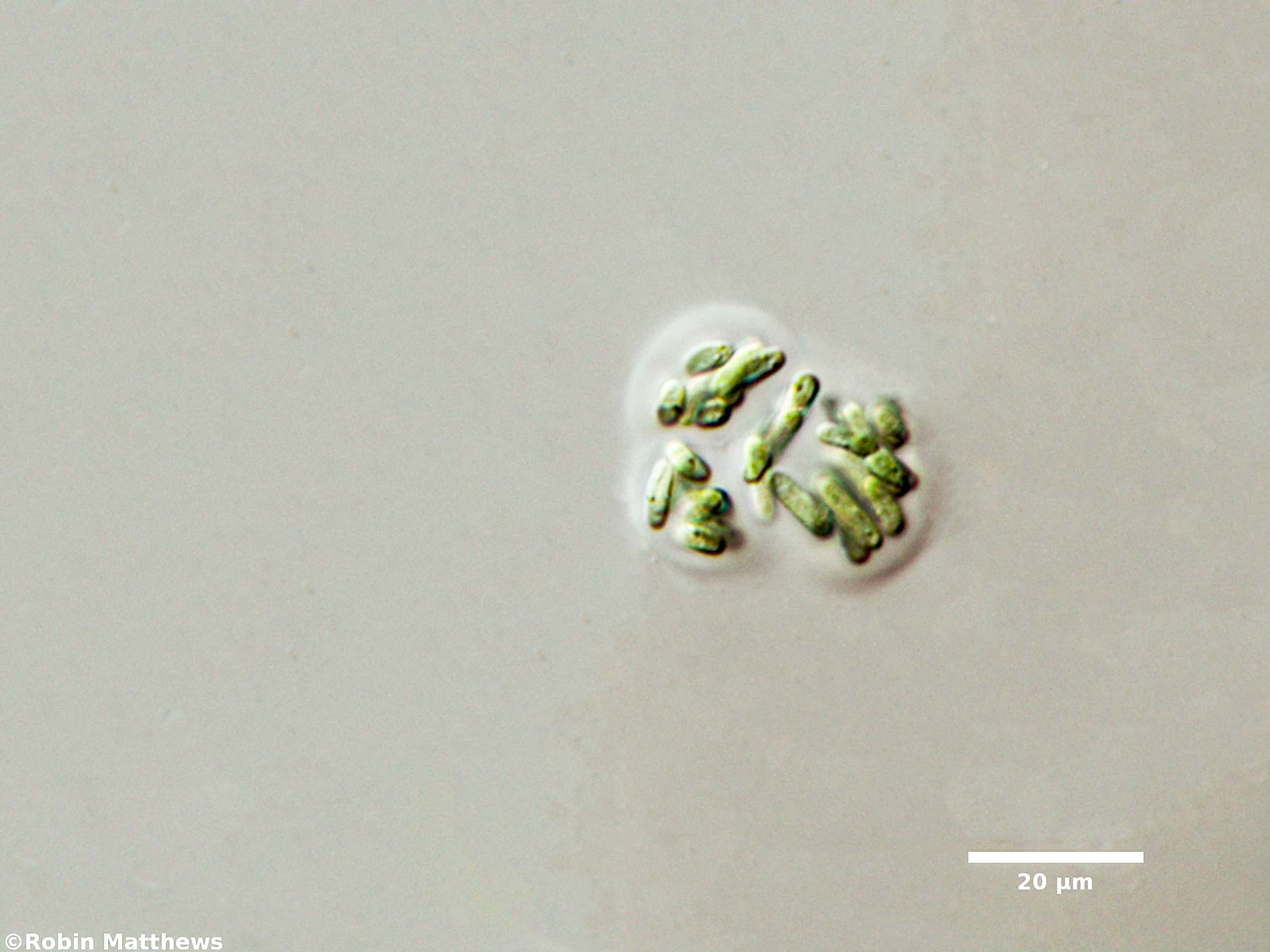 Cyanobacteria/Synechococcales/Synechococcaceae/Rhabdogloea/linearis/rhabdogloea-linearis-73.jpg
