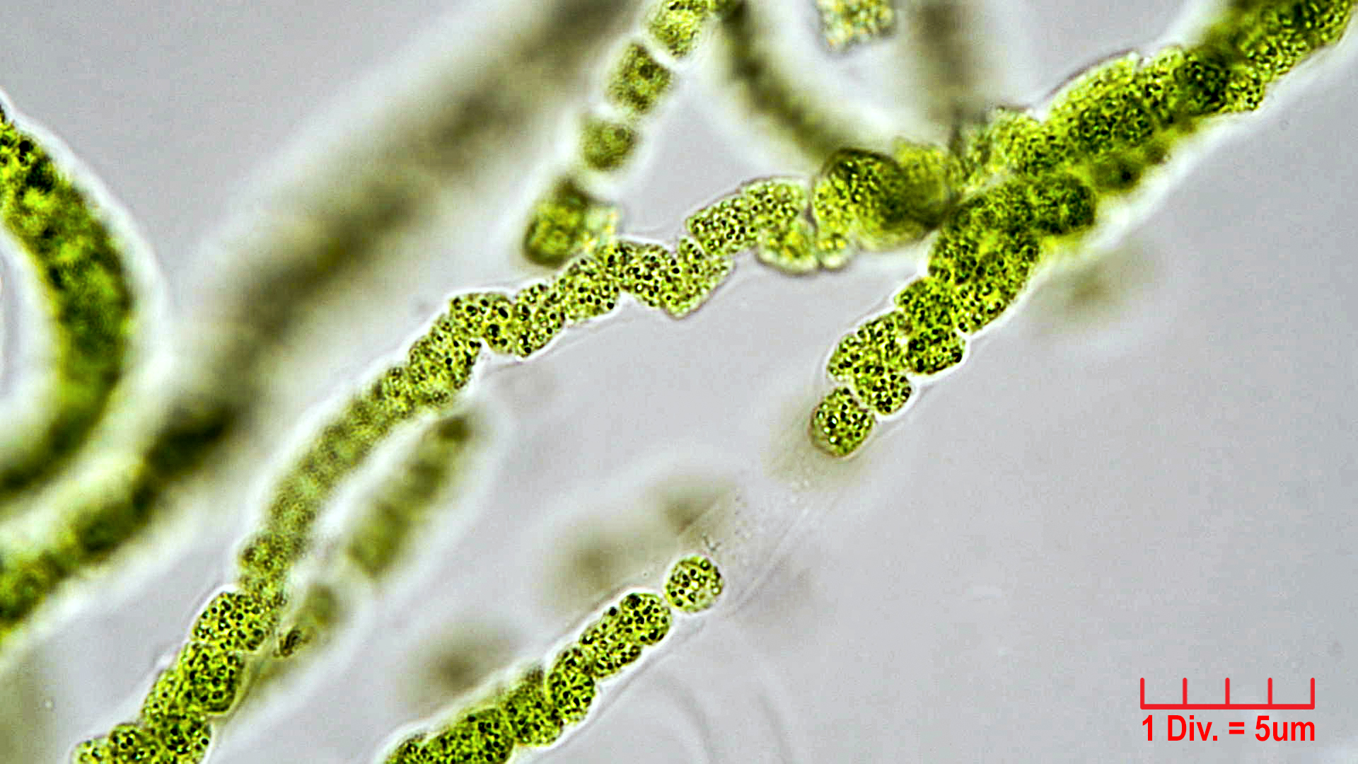 Cyanobacteria/Unknown/1004.jpg